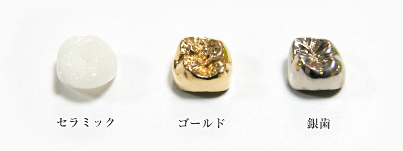 詰め物・被せ物の素材の比較