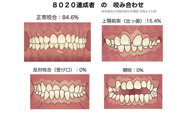 8020達成の必須条件とは！？
