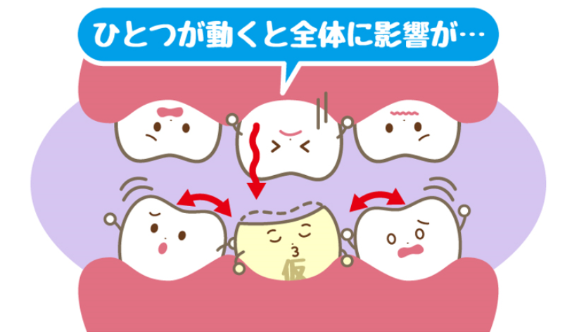 2024年3月 仲町歯科ブログ