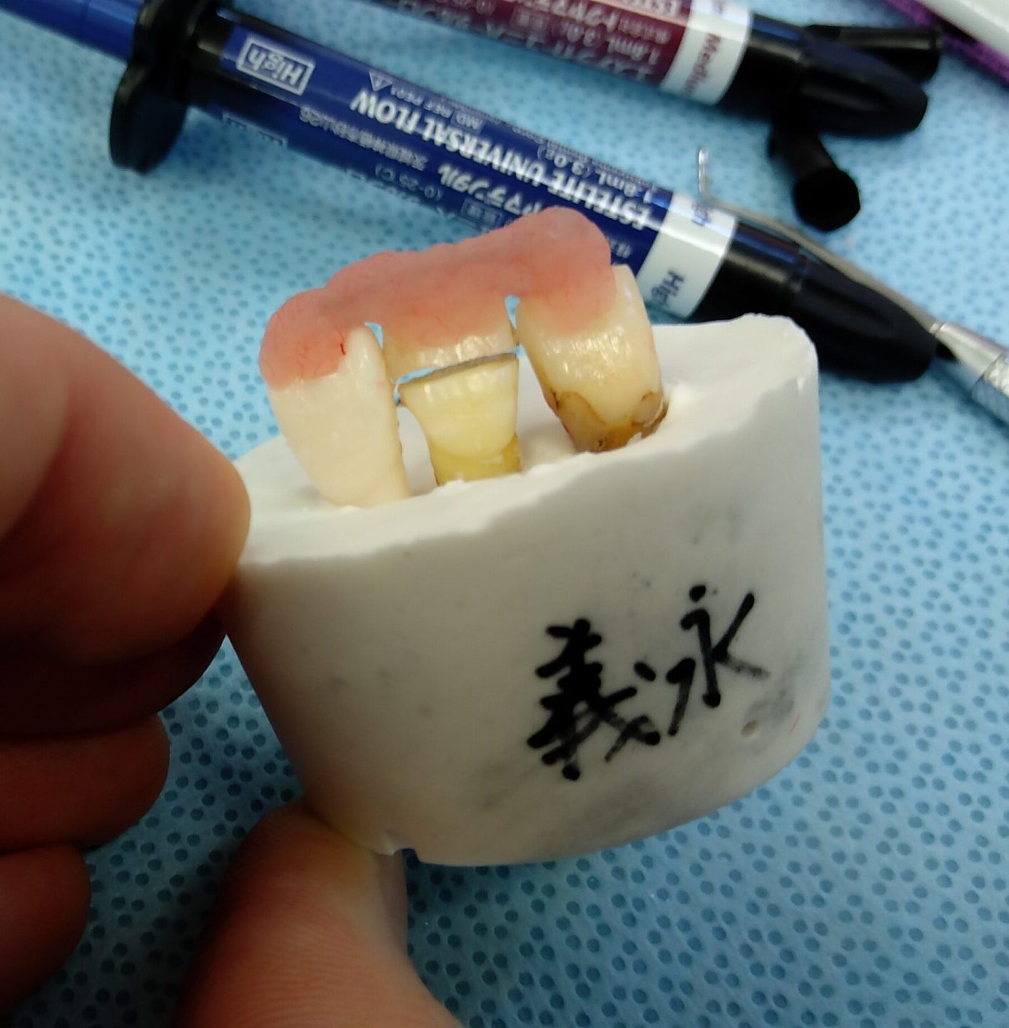 外傷の実習で使用した欠けた歯の模型