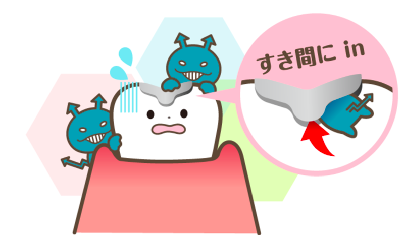 隙間にIN