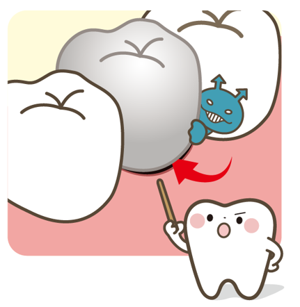 寿命をむかえると虫歯ができる