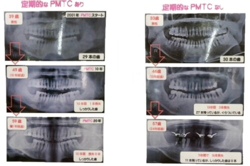 定期的なPMTCの有無