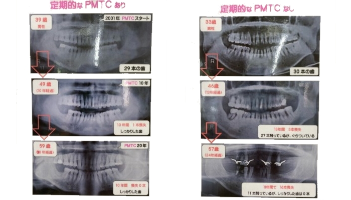 定期的なPMTCの有無