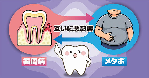メタボと歯周病は互いに影響し合う関係を表したイラスト